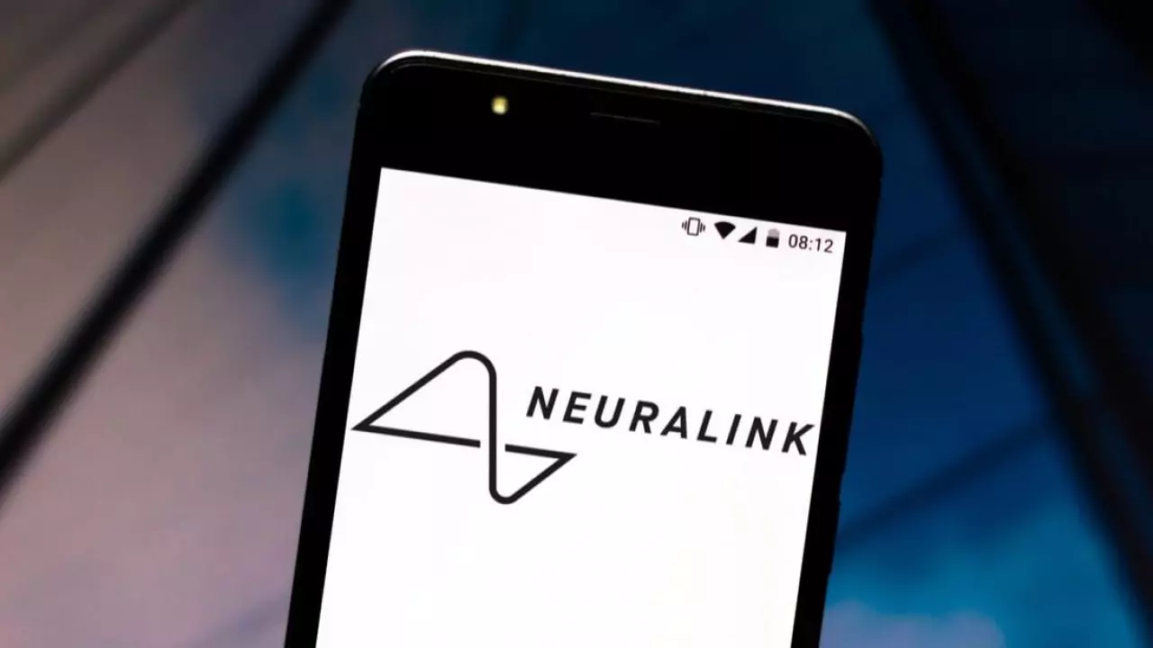 Neuralink