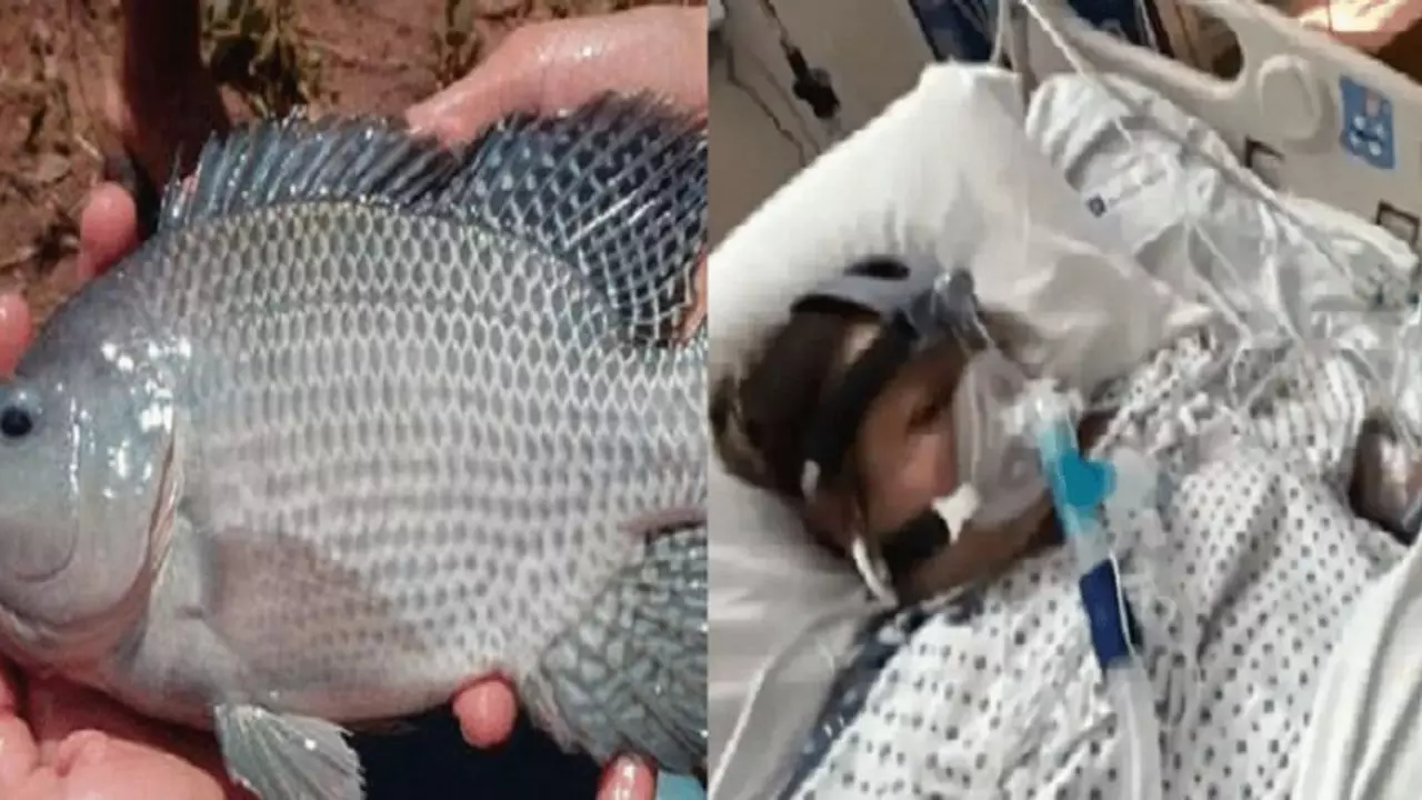 California Woman Loses Limbs Due to Undercooked Tilapia Fish