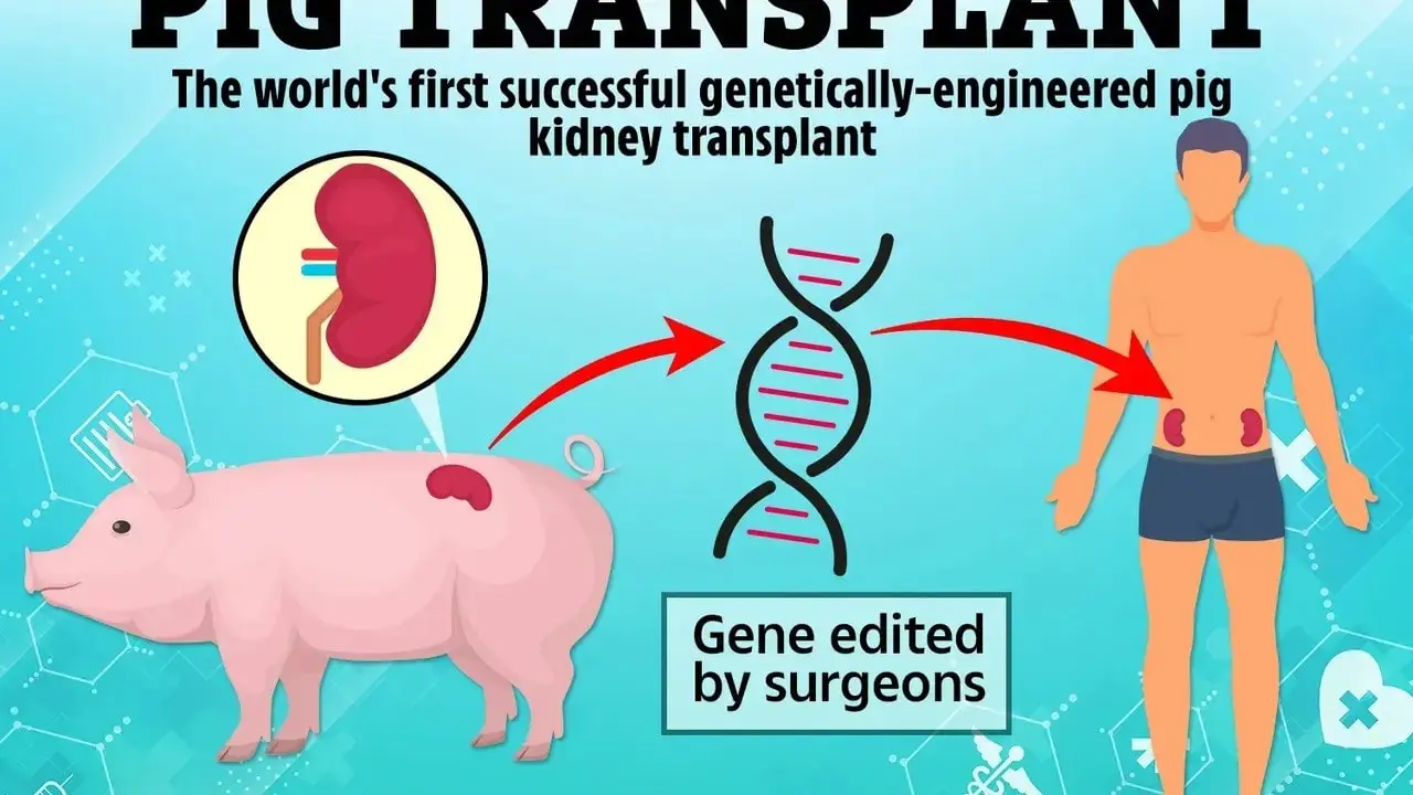 genetically modified pig kidney transplant